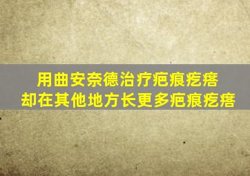 用曲安奈德治疗疤痕疙瘩 却在其他地方长更多疤痕疙瘩